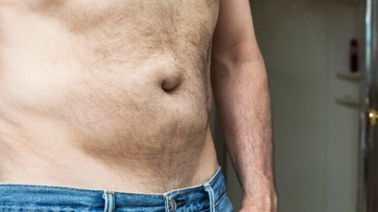 Stoma Brüche