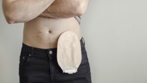 Stoma Bandage