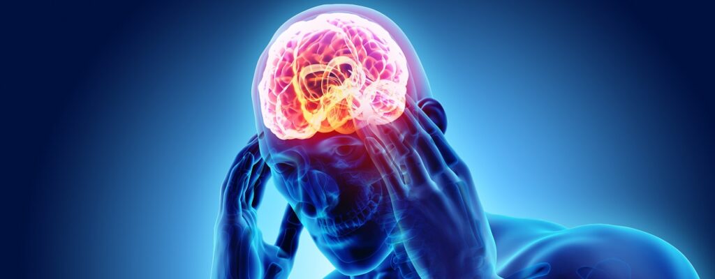 Neurologische Erkrankungen