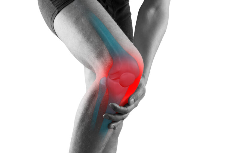 Knie- und Hüftarthrose